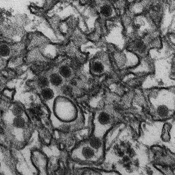 This is a transmission electron micrograph (TEM) of Zika virus, which is a member of the family Flaviviridae. (Photo credit: CDC/ Cynthia Goldsmith)